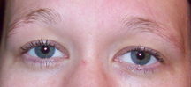 Brows1083Before