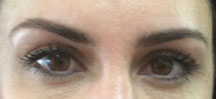 Brows1708After