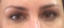 Brows1708before
