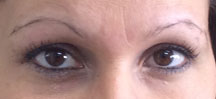 Brows1766Before